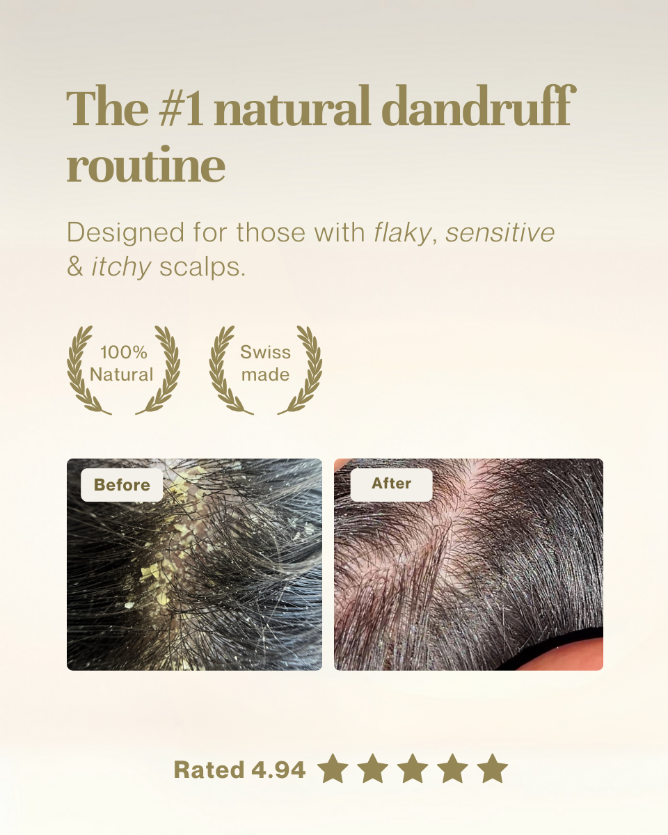Natural scalp oil for dandruff
