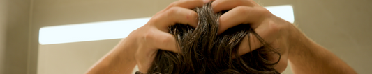 5 Things I wish I’d known sooner about healing Scalp Psoriasis & Chronic Dandruff (seb derm)