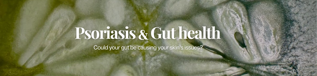 Is Leaky Gut Causing Your Psoriasis?