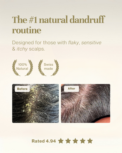 Natural scalp oil for dandruff