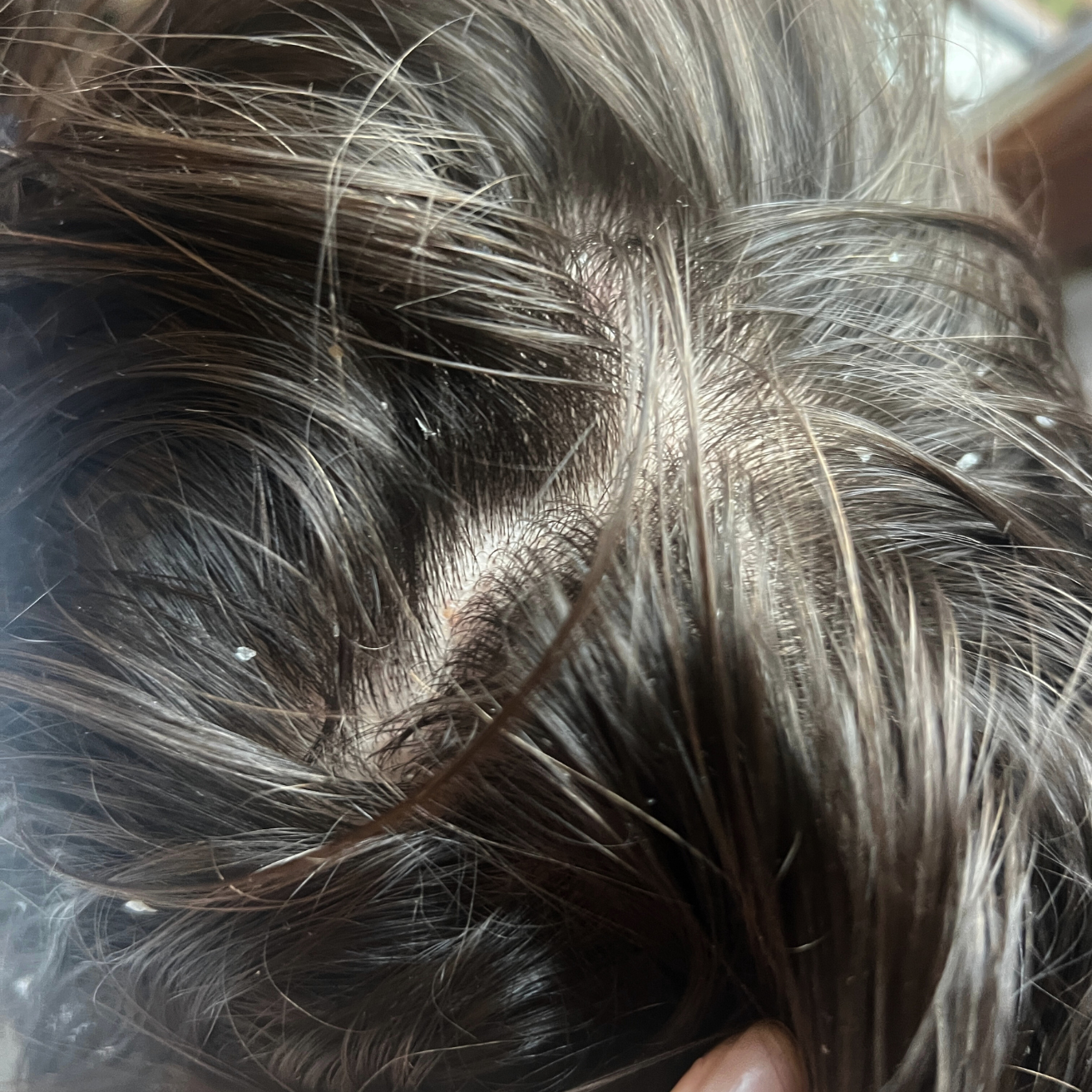 Before image