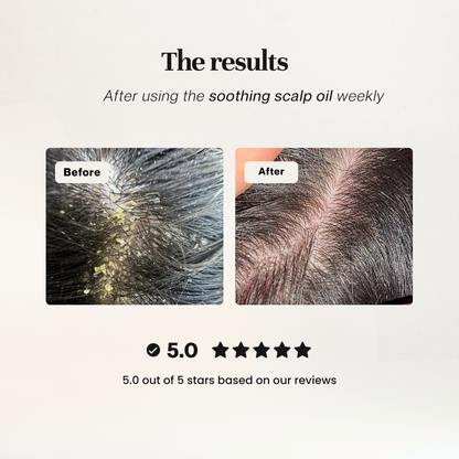 Soothing Scalp Oil Bundle